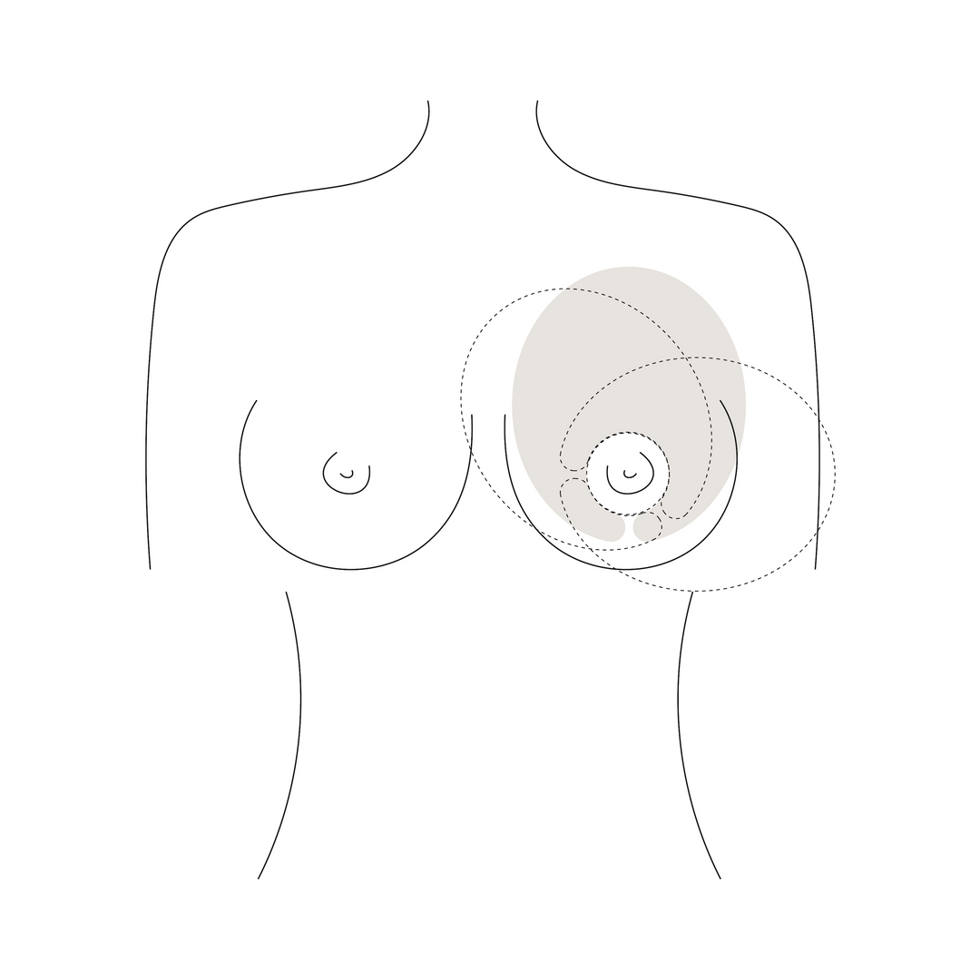 Hot &amp; Cold Thermal Therapy Breast Packs (2 Pack)