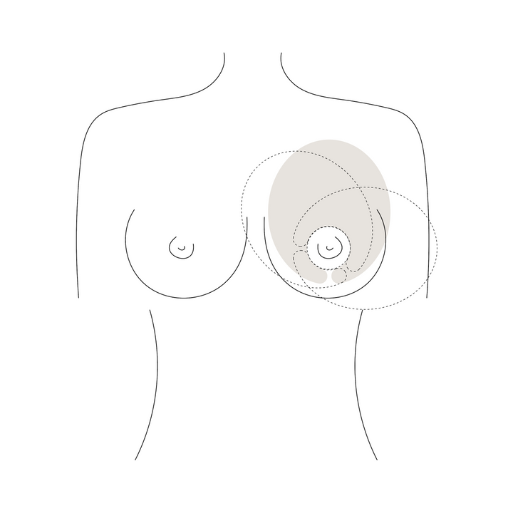 Hot &amp; Cold Thermal Therapy Breast Packs (2 Pack)