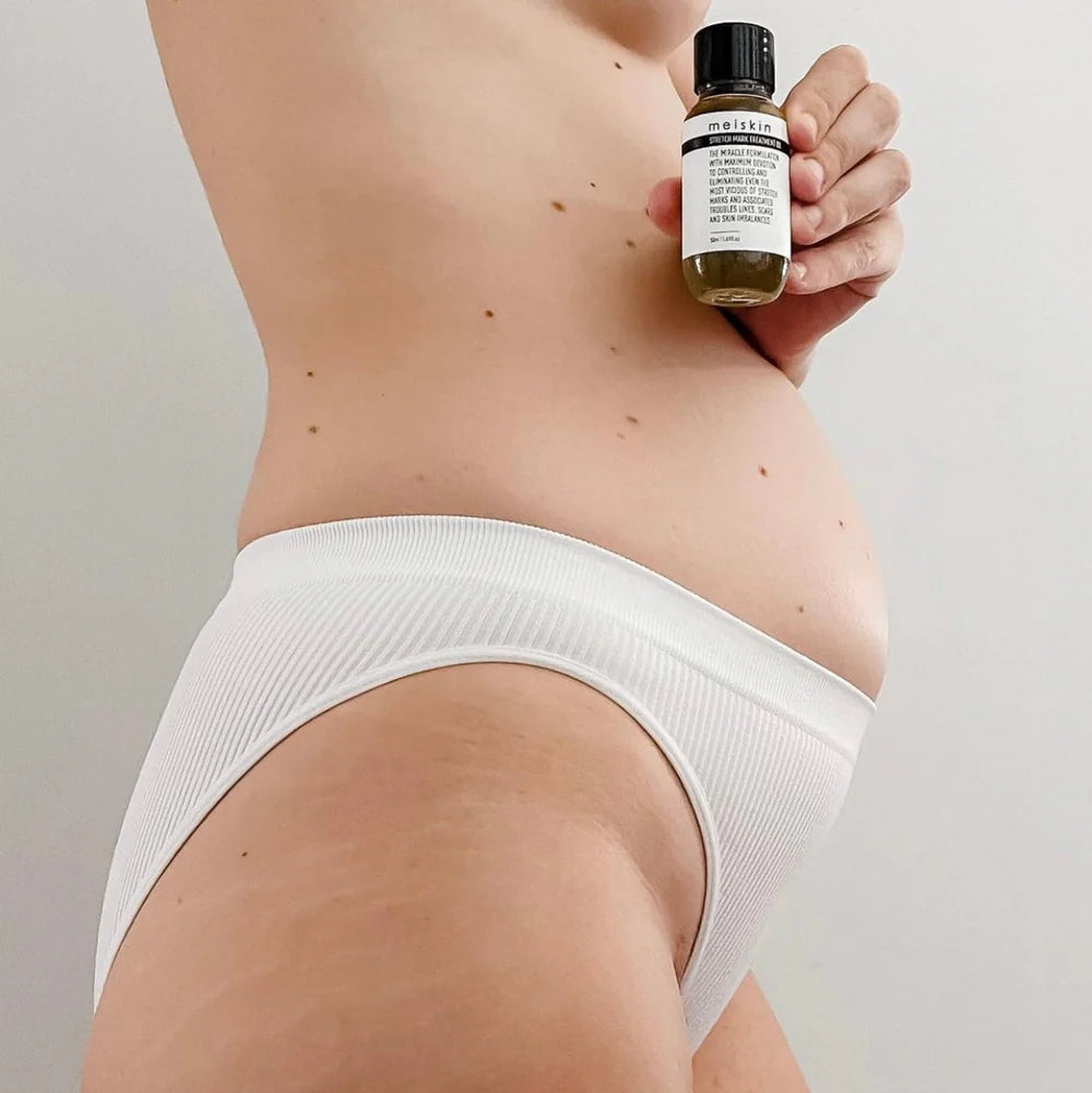 Stretch Mark Treatment &amp; Scar Oil